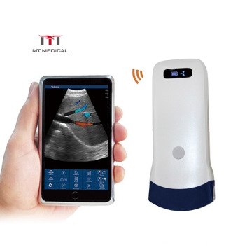 Newest Design 128 Elements Mini WiFi Wireless Portable Color Doppler Convex Probe Ultrasound Scanner